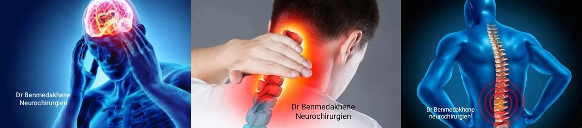 La Mésothérapie Antidouleur : Une Approche Révolutionnaire et Sécurisée